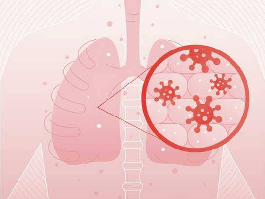 chest-infection-near-kondapur