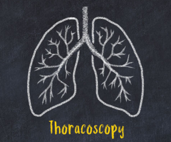 thoracoscopy-near-kondapur
